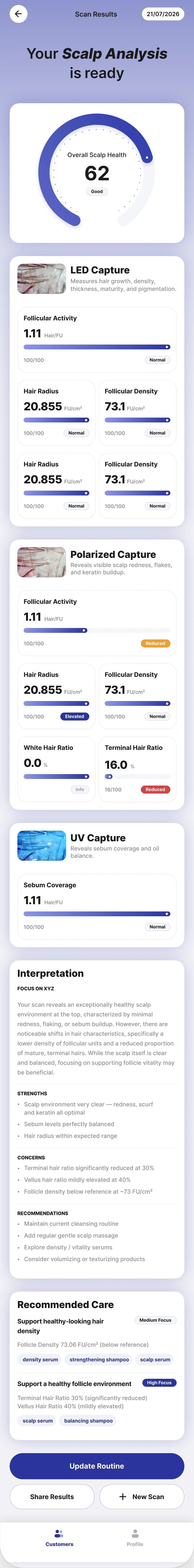 Scan results screen showing an overall scalp health score of 62